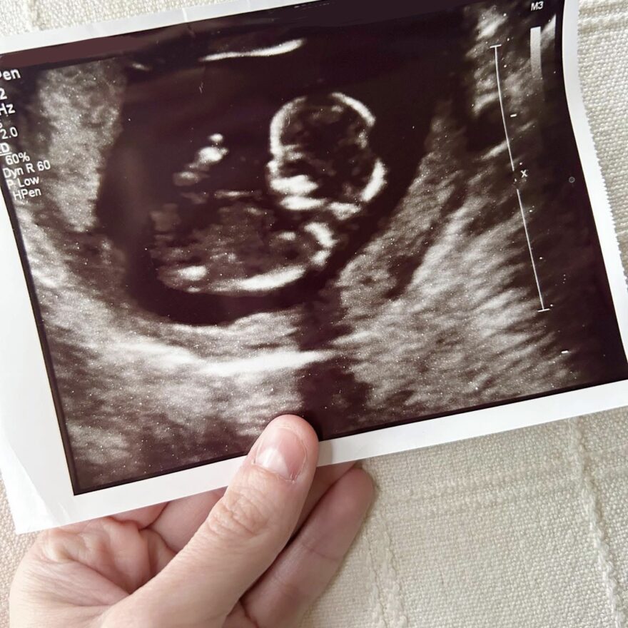 Miscarriage grief at christmas. My hand holding the sonogram of the baby we lost.